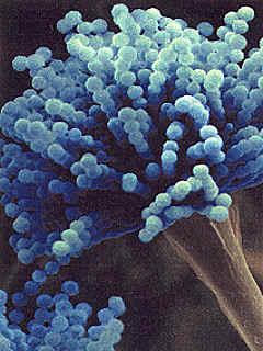 aspergillus niger unter dem Mikroskop